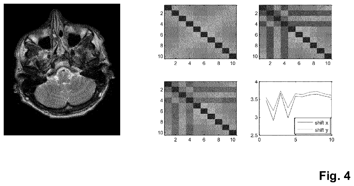 MR imaging with motion detection