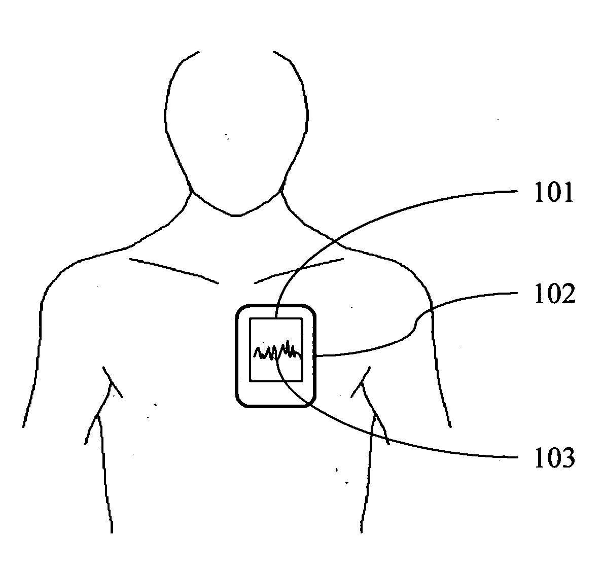 Physiological data recording apparatus for single handed application