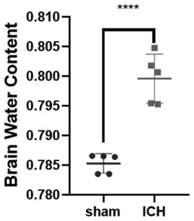 Modeling method of mouse hypertensive cerebral hemorrhage model