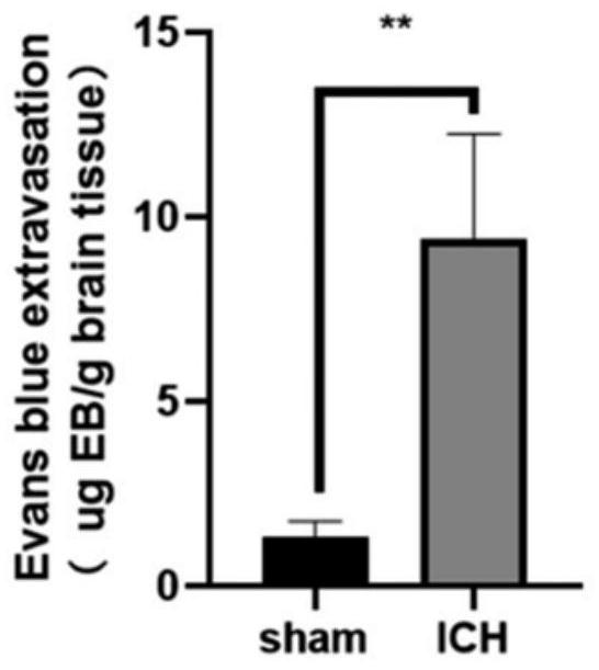 Modeling method of mouse hypertensive cerebral hemorrhage model