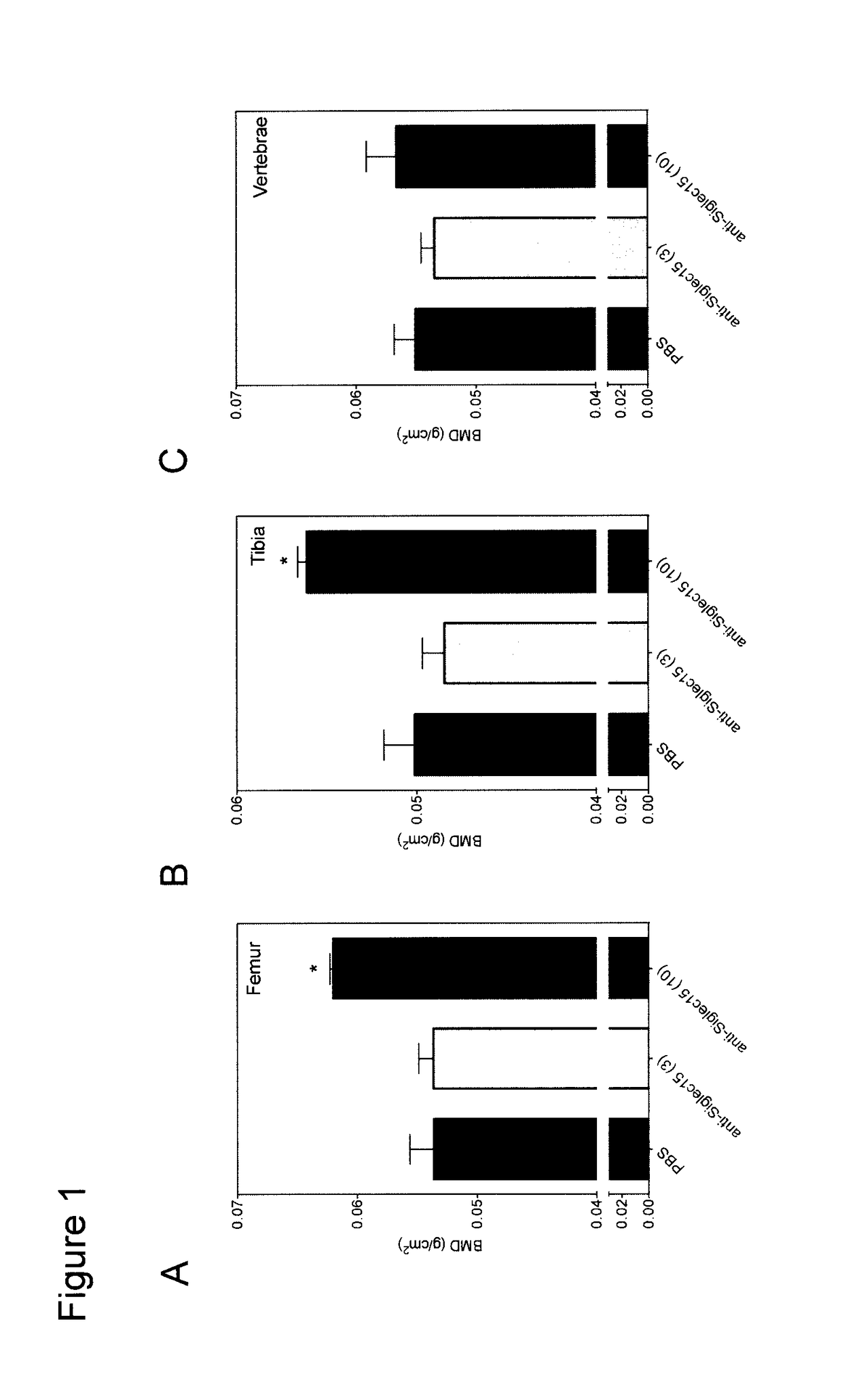 Anti-siglec-15 antibodies for use in treatment of osteogenesis imperfecta