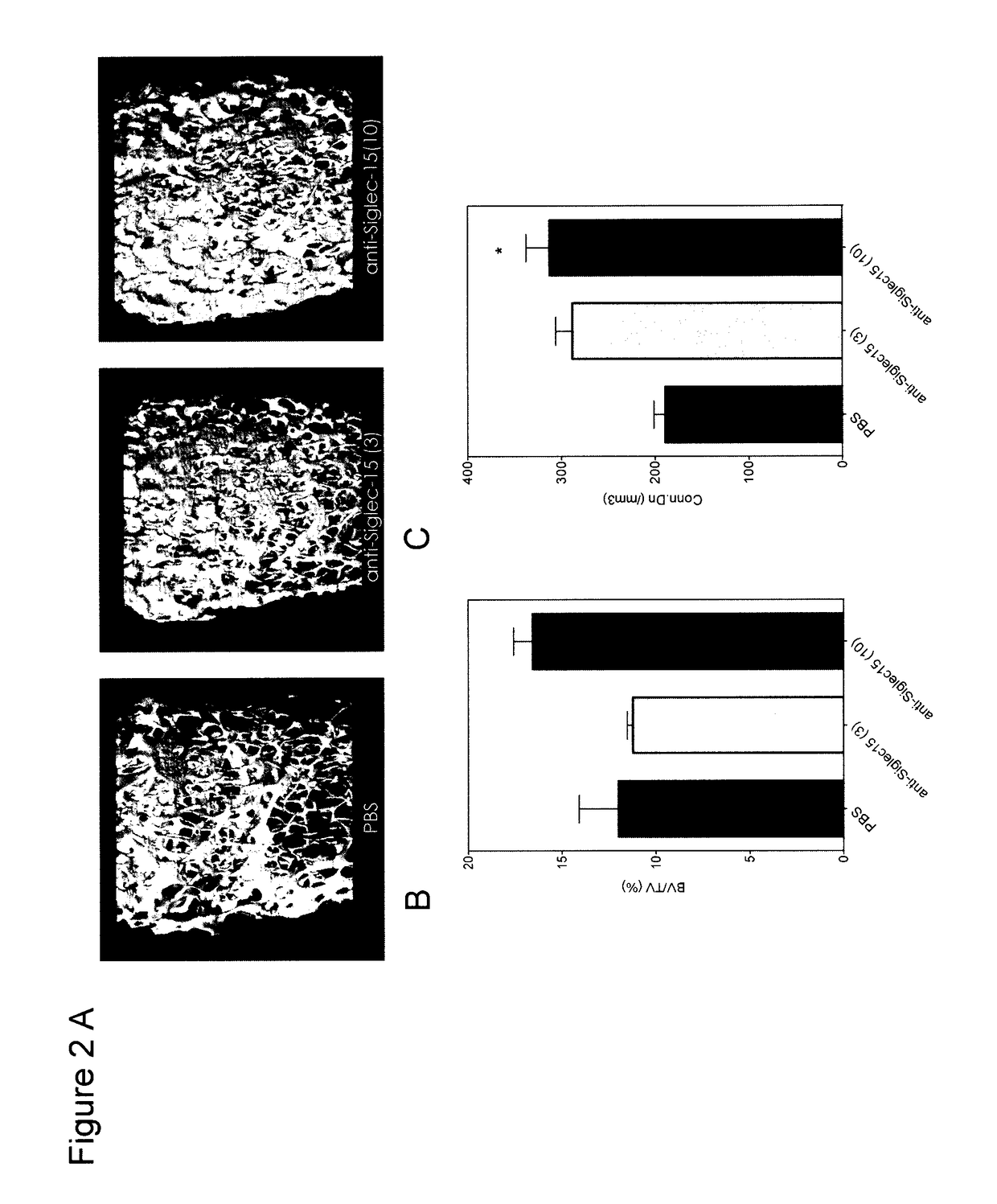 Anti-siglec-15 antibodies for use in treatment of osteogenesis imperfecta