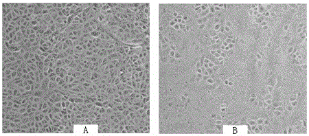 A strain of porcine epidemic diarrhea virus and its culture method and application