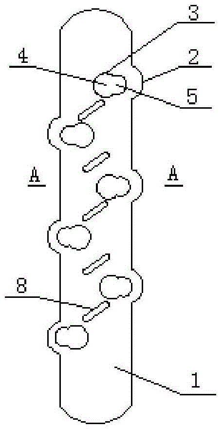 Locking metal bone fracture fixation plate