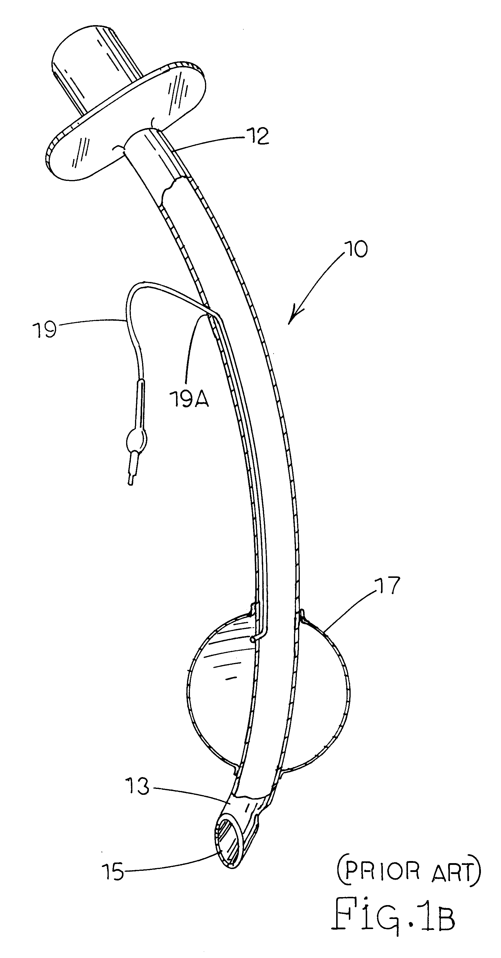 Separable double lumen endotracheal tube