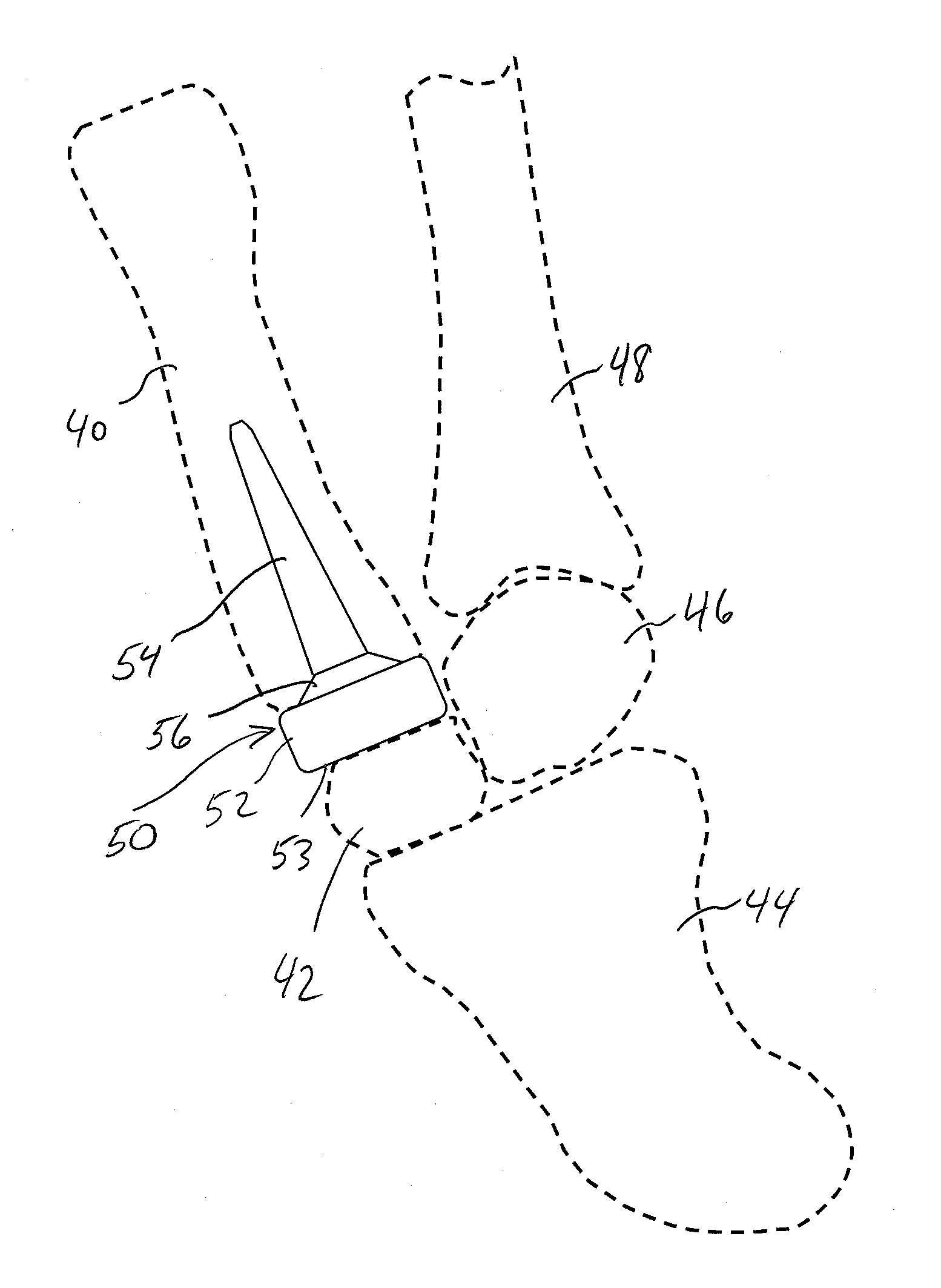 Polycarbonate urethane joint implant