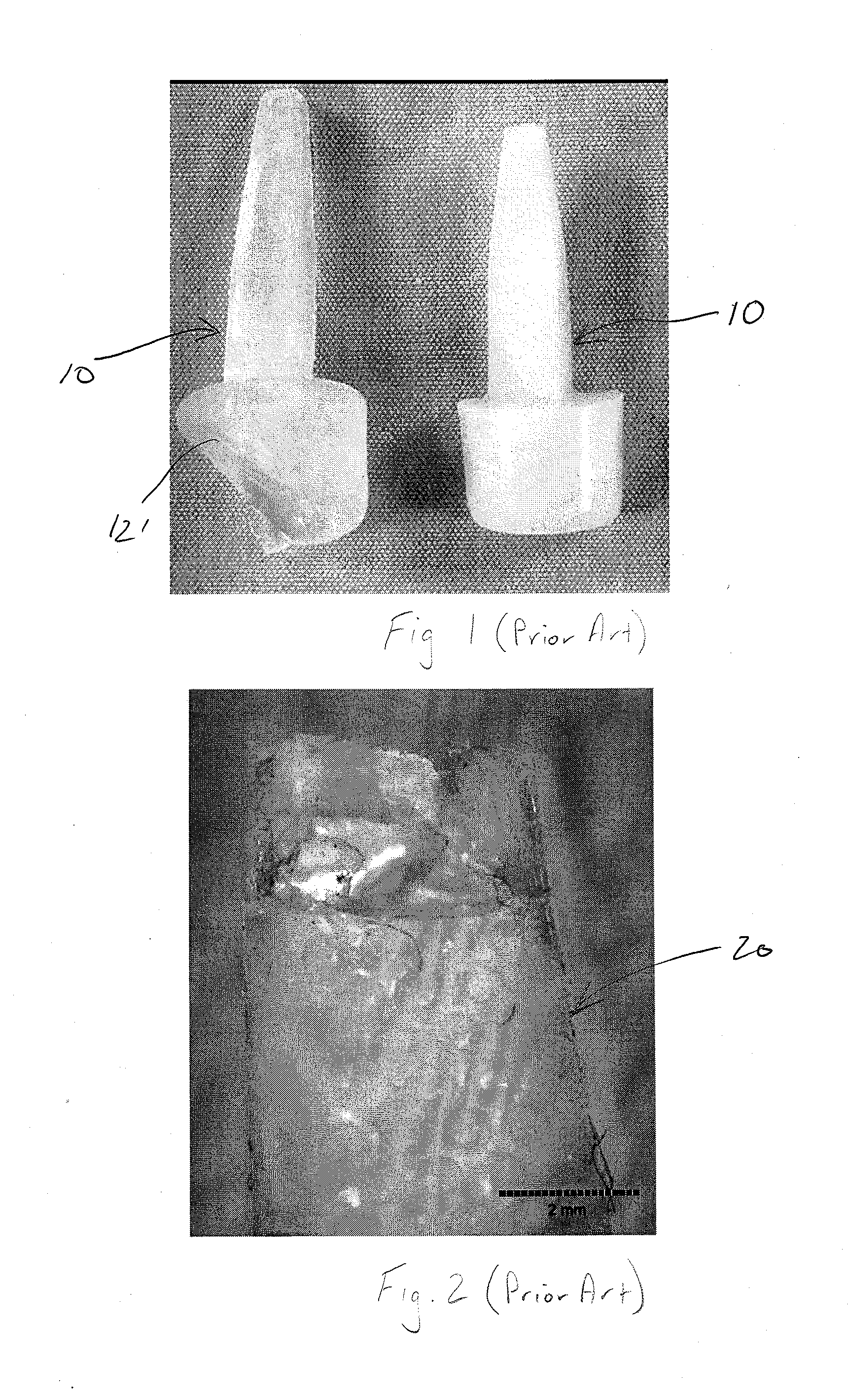 Polycarbonate urethane joint implant