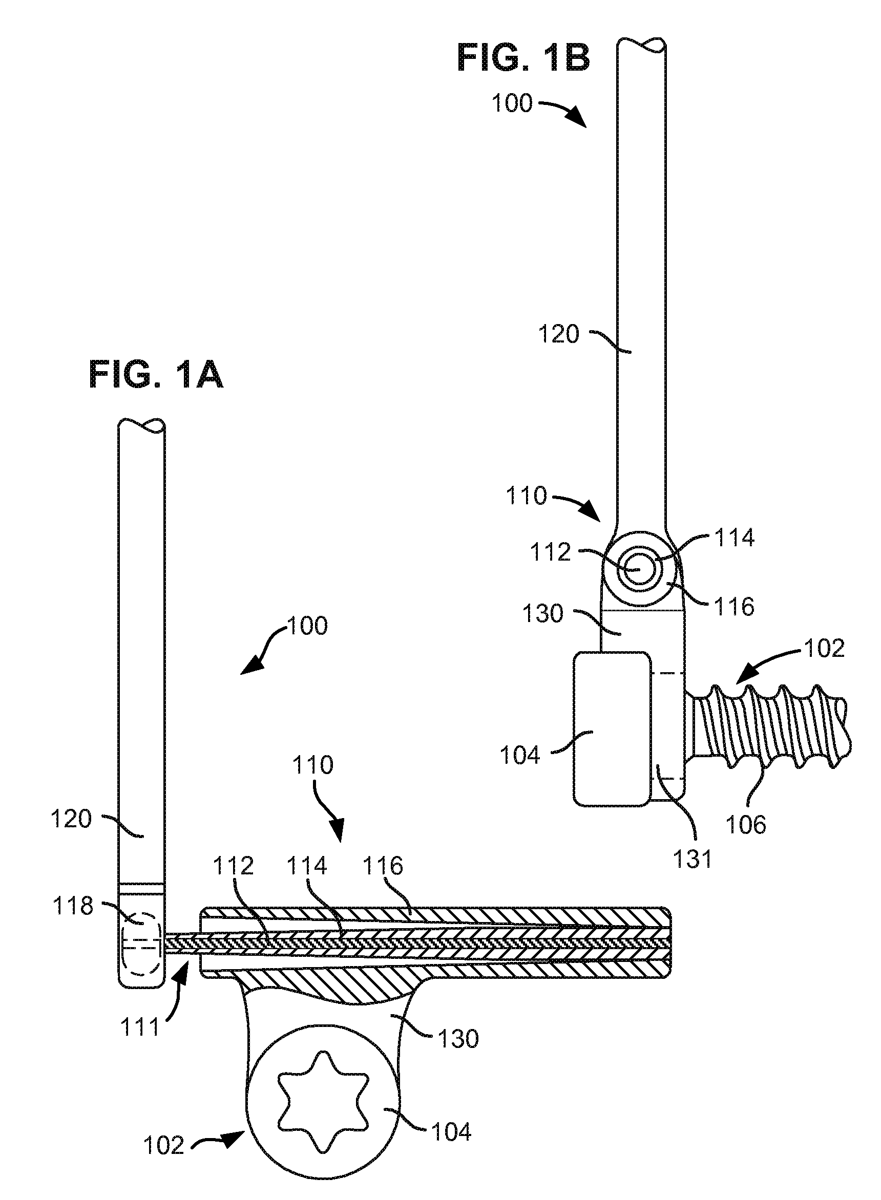 Modular in-line deflection rod and bone anchor system and method for dynamic stabilization of the spine