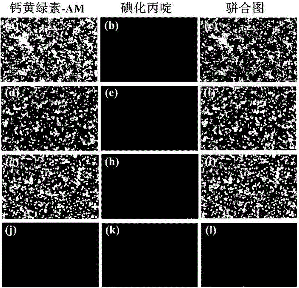 Metal [beta]-lactamase inhibitor cyclo-amidodithioformate derivative and preparation method of same