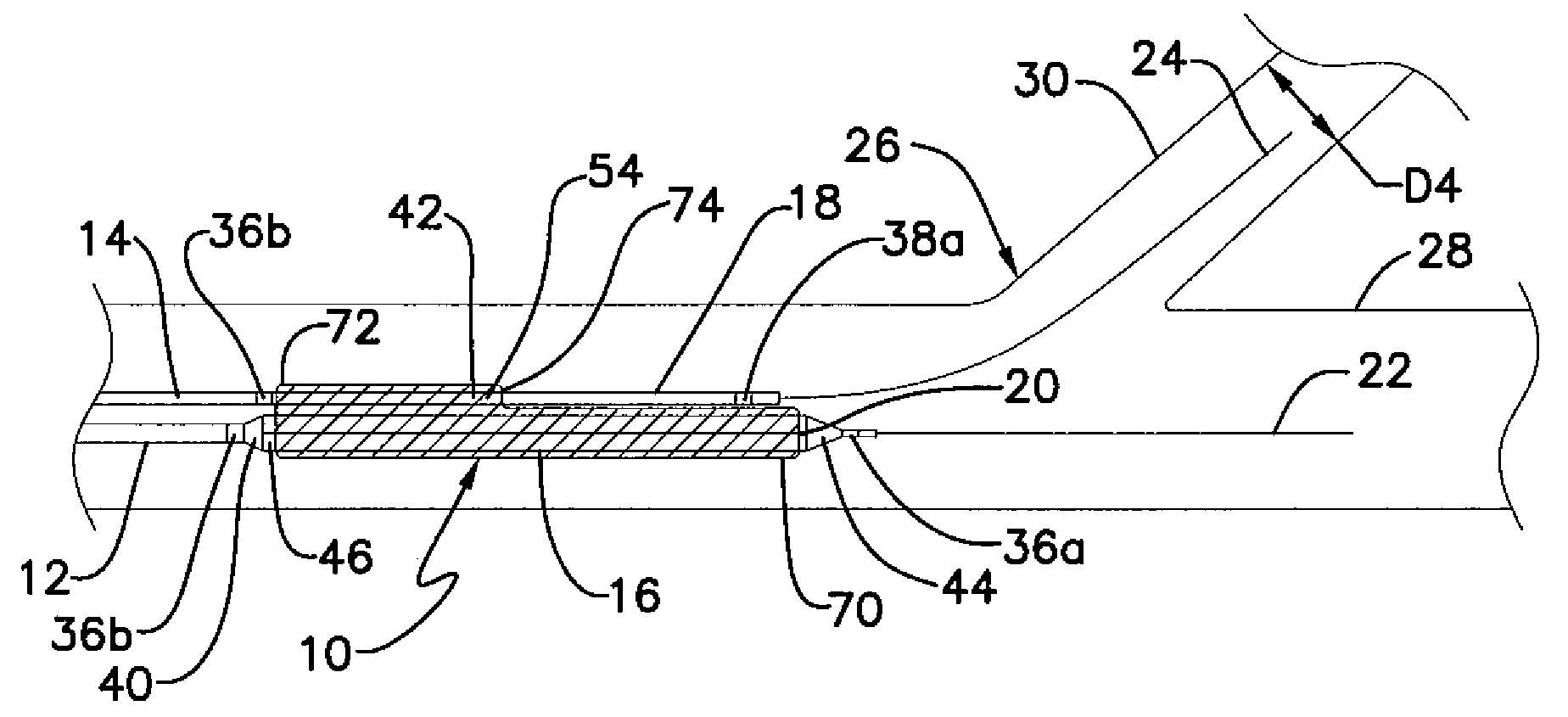 Bifurcation stent delivery system and methods