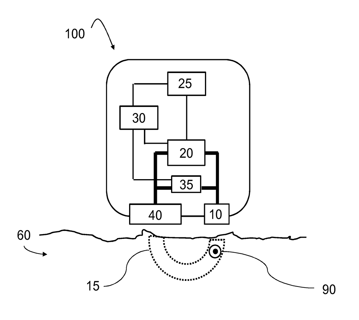 Non-invasive skin treatment device using r.f. electrical current with a treatment settings determiner