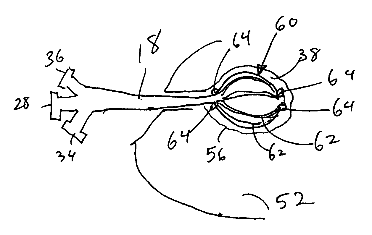 Vacuum device and method for treating tissue adjacent a body cavity