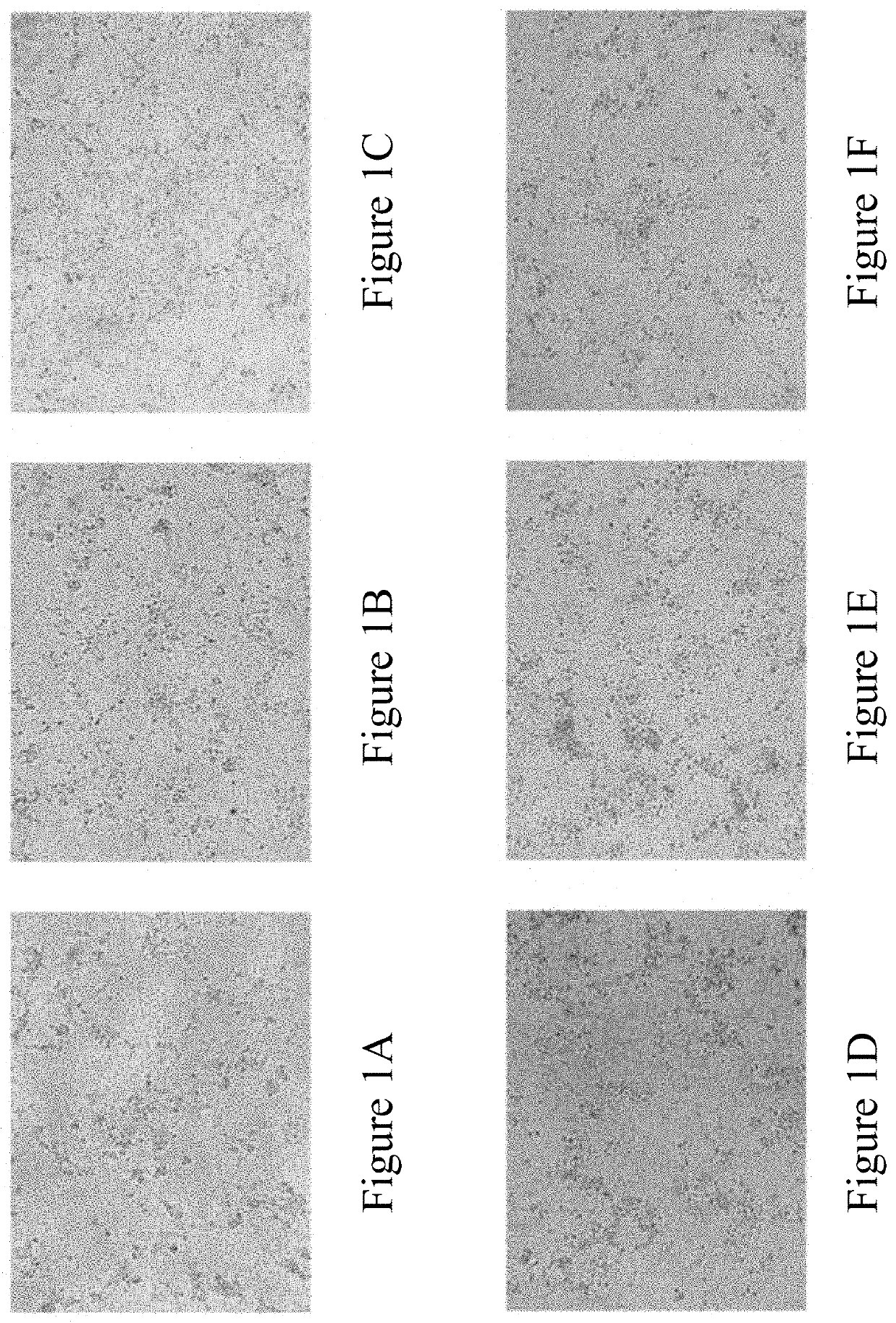 Method for treating and/or preventing alzheimer's disease