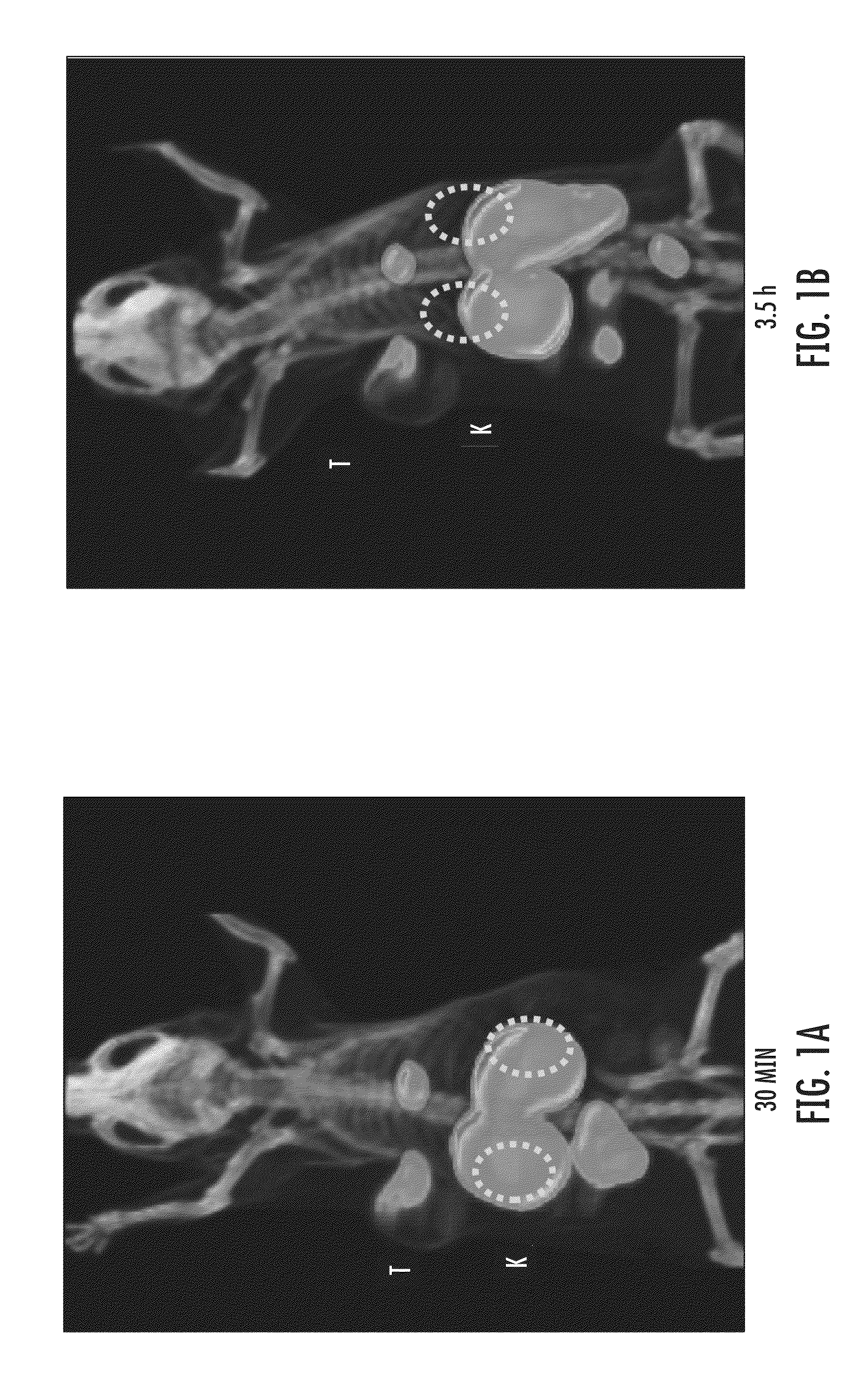 Psma-targeting compounds and uses thereof