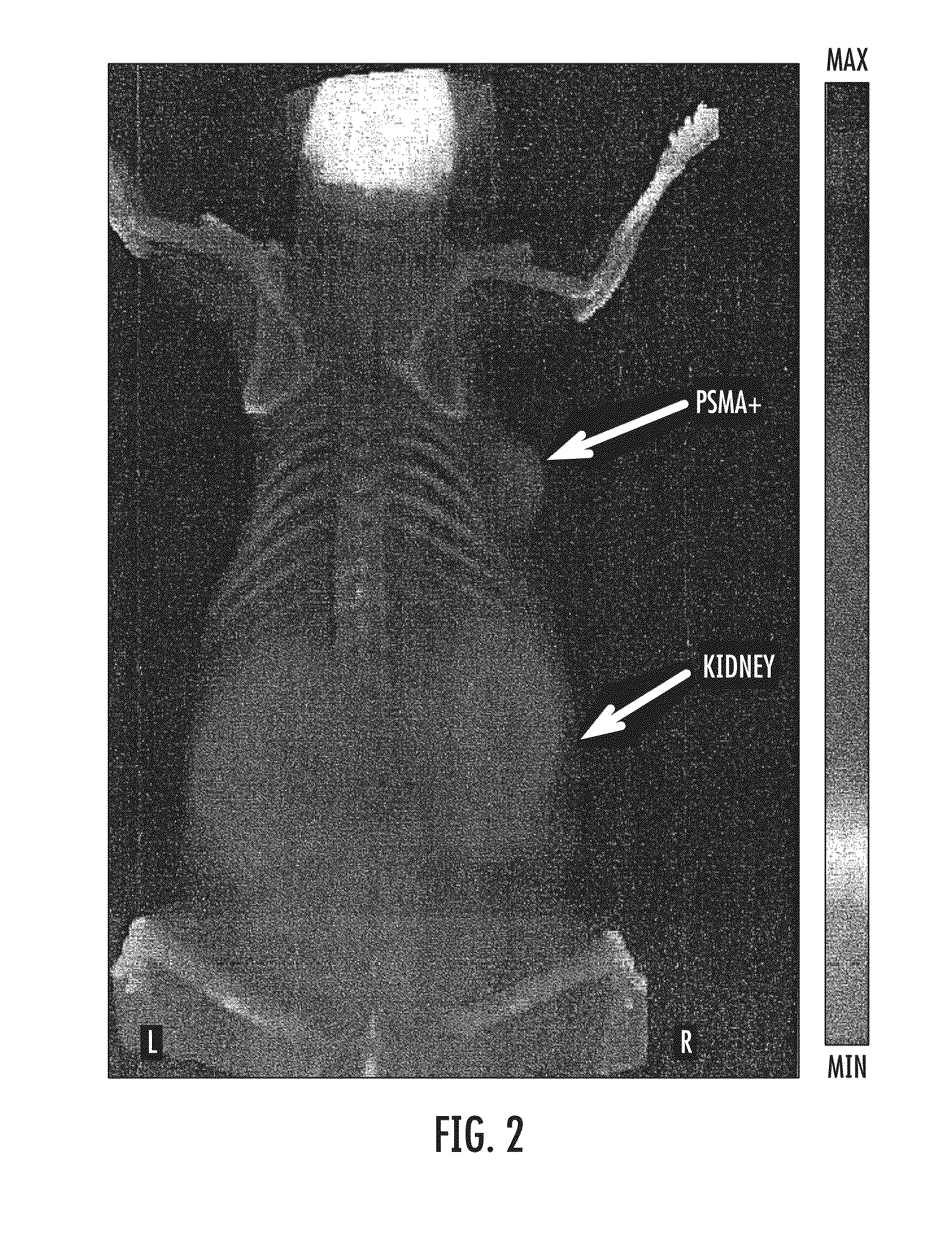 Psma-targeting compounds and uses thereof