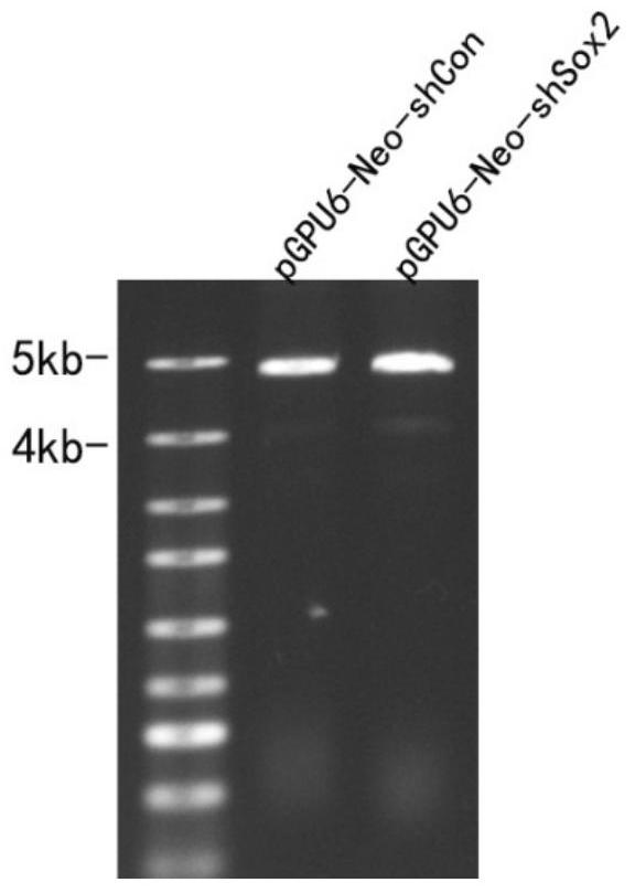 A genetically engineered bacterium that inhibits tumor growth and its construction method and application