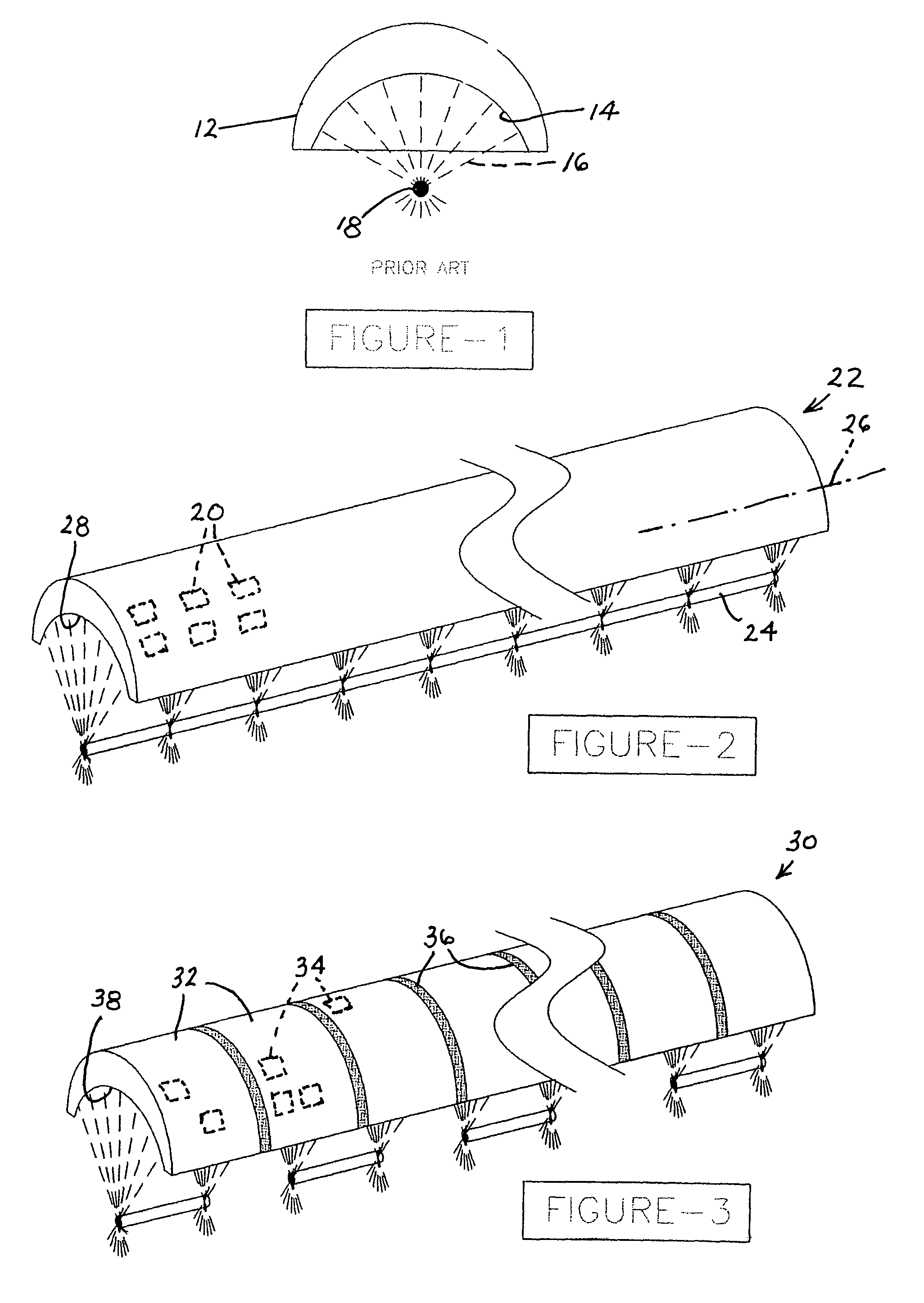 Ultrasonic medical treatment device with variable focal zone