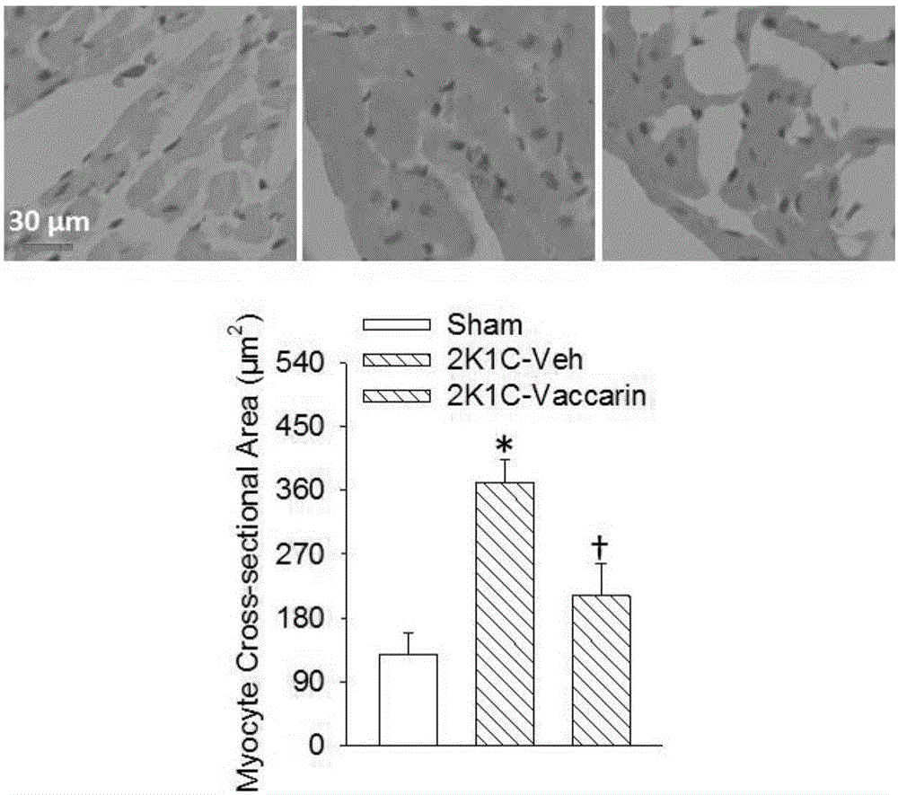 Application of Vaccarin in preparation of antihypertensive drugs