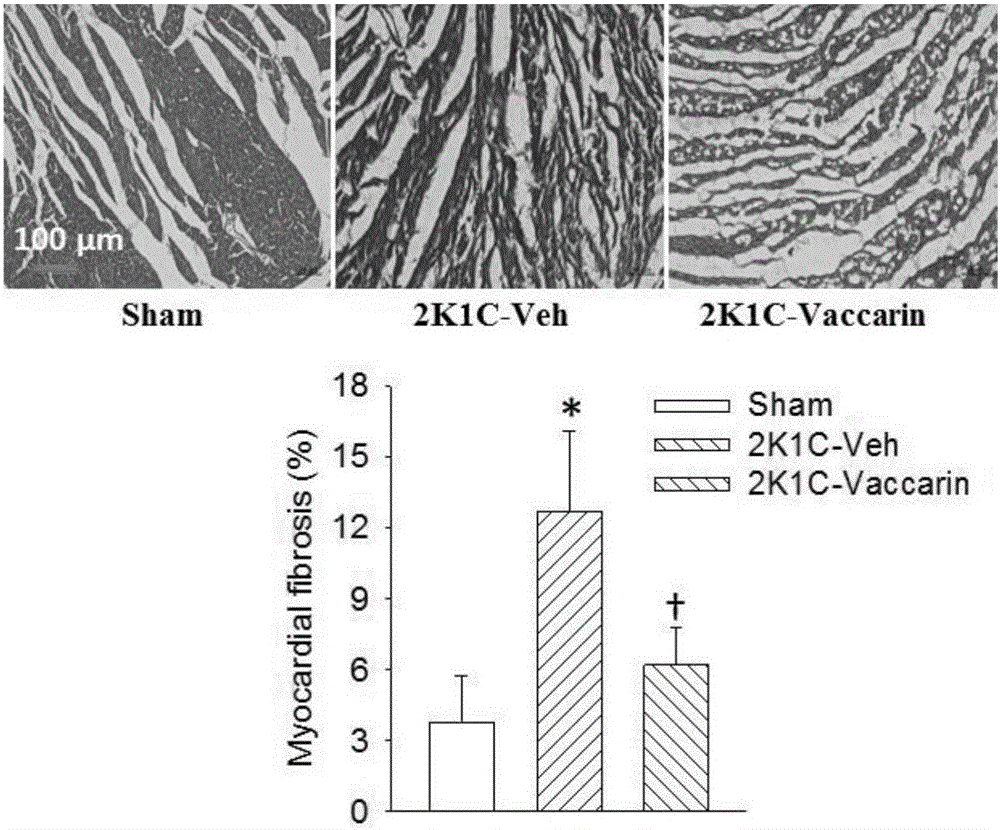 Application of Vaccarin in preparation of antihypertensive drugs