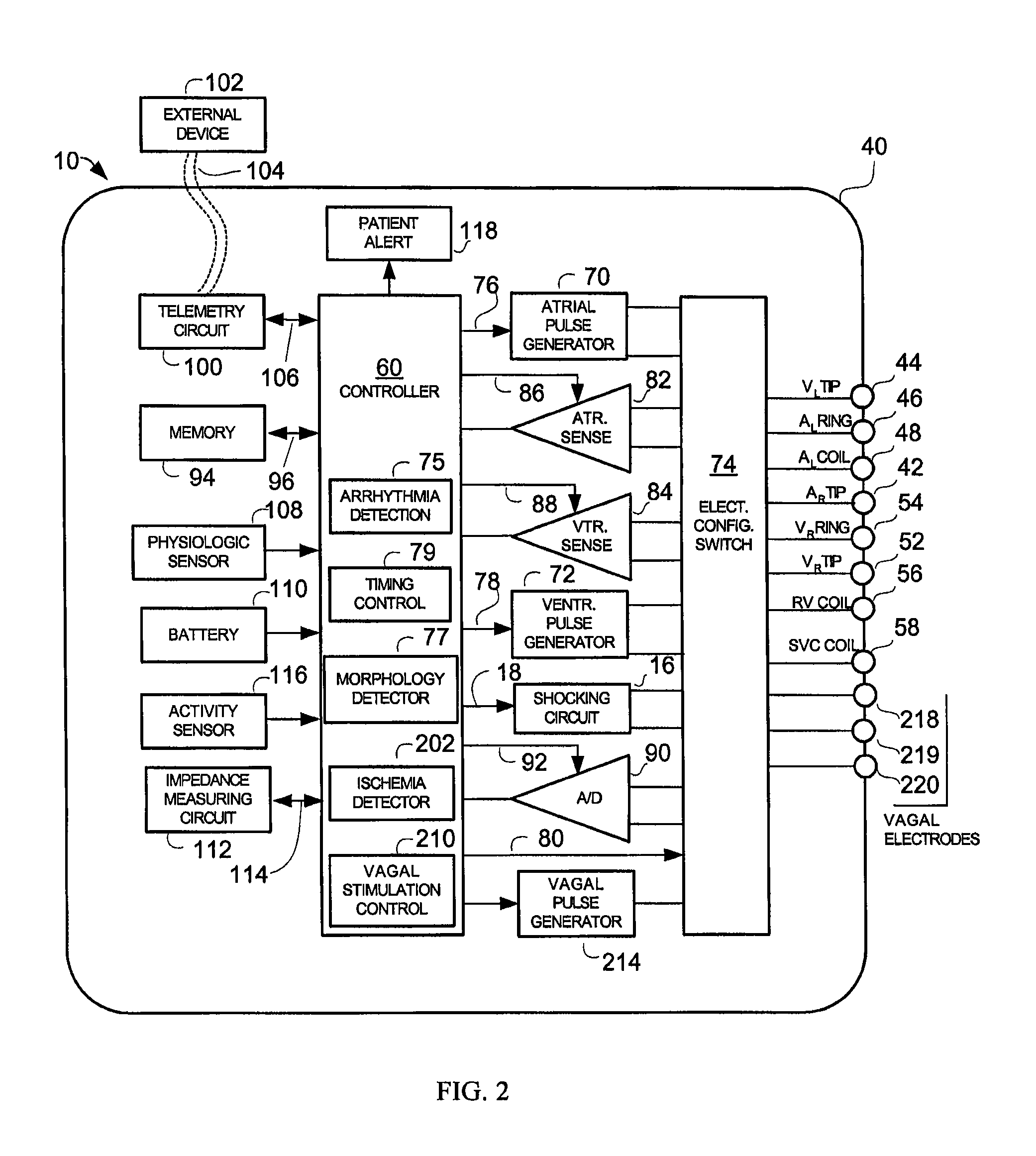 Systems and methods for detecting ischemic events