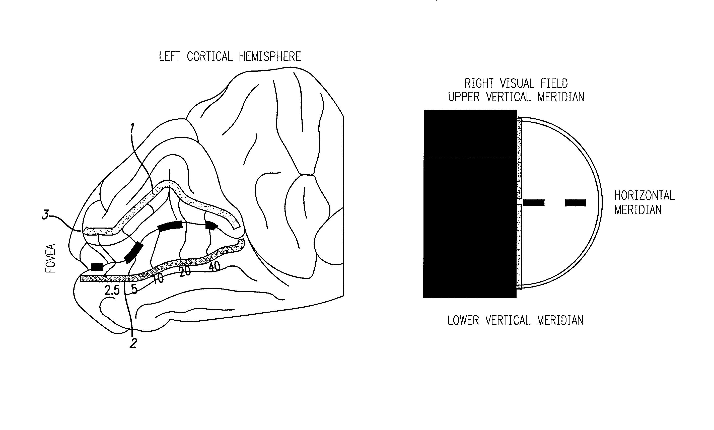 Cortical visual prosthesis