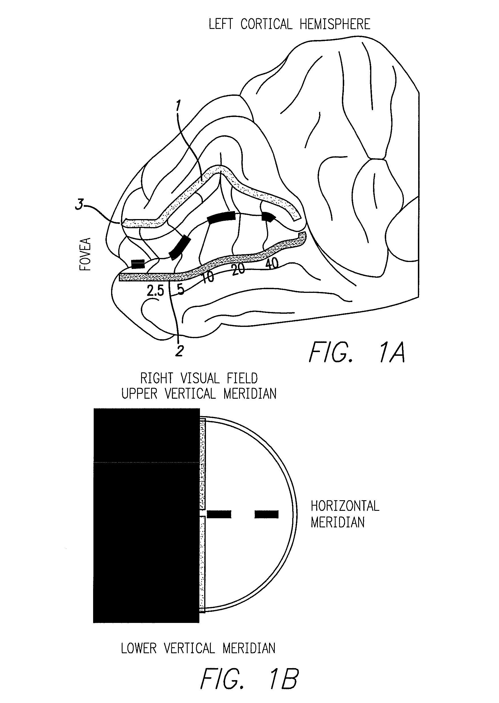 Cortical visual prosthesis