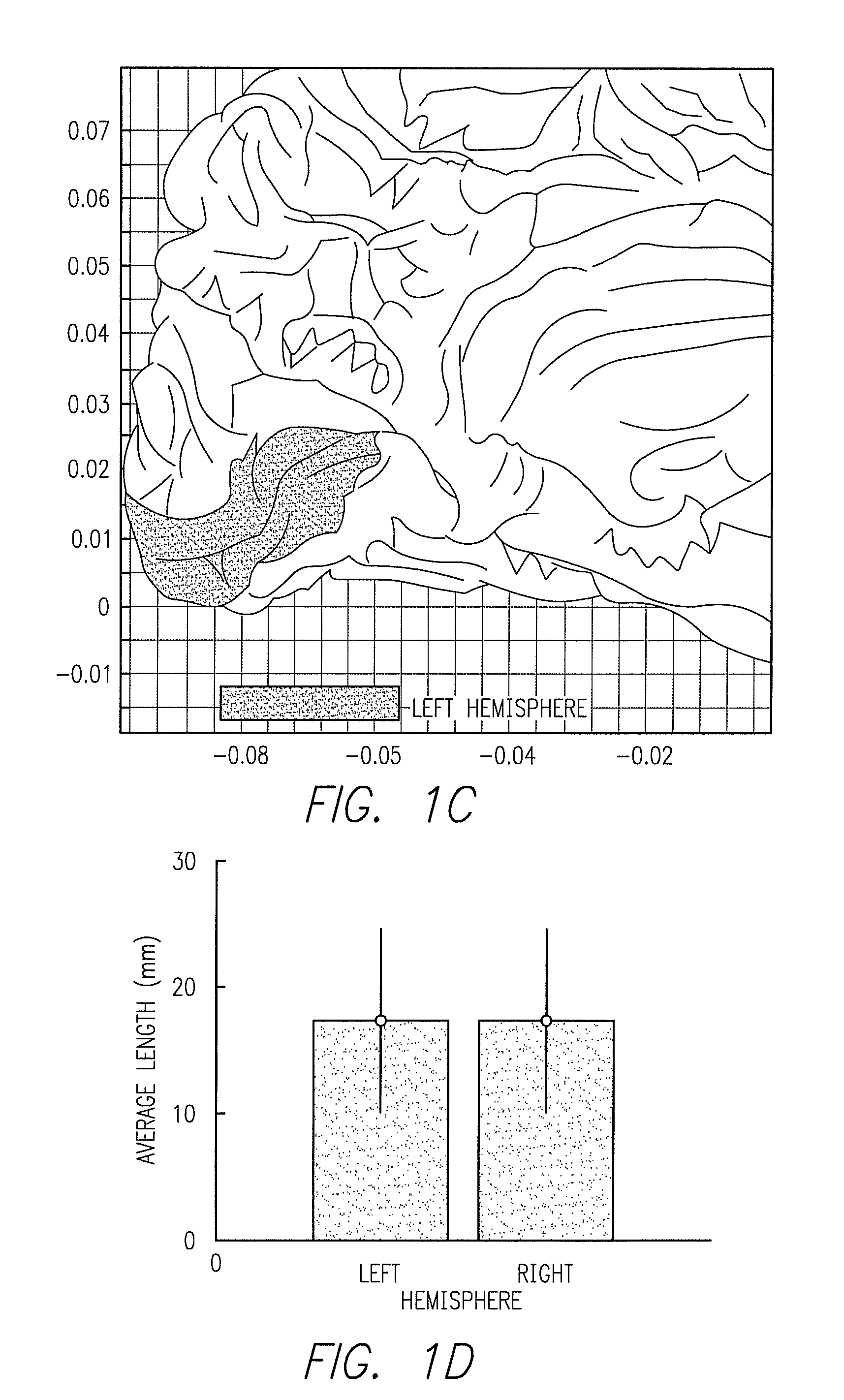 Cortical visual prosthesis