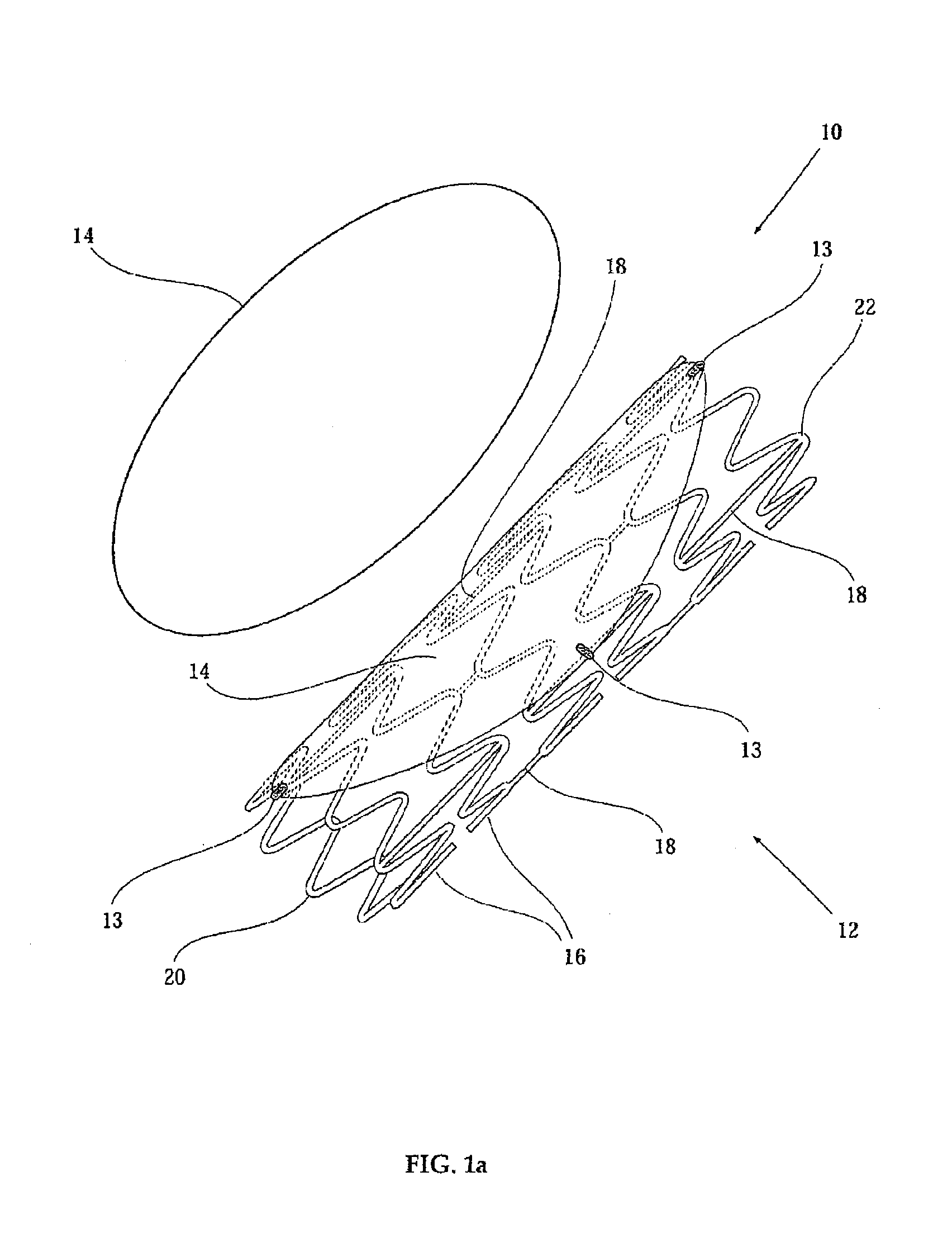 Implantable graft assembly