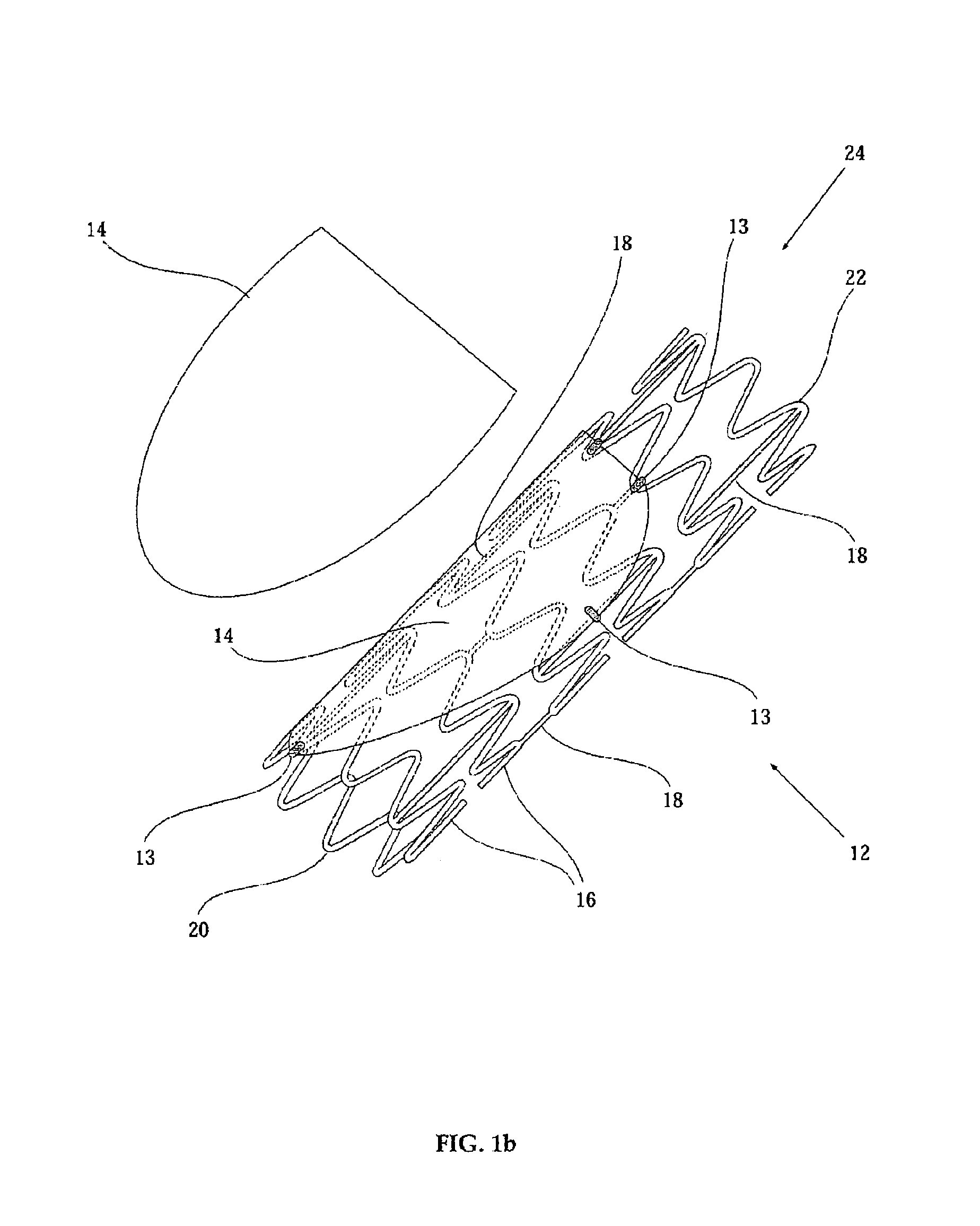 Implantable graft assembly