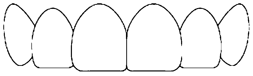 Digital model selection manufacturing method for anterior teeth aesthetics forms based on gas quality classification