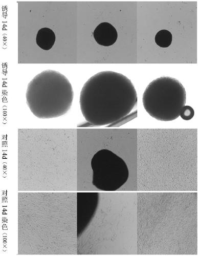 A kind of preparation method of stem cell active factor freeze-dried powder