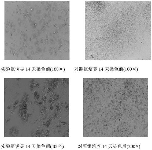 A kind of preparation method of stem cell active factor freeze-dried powder