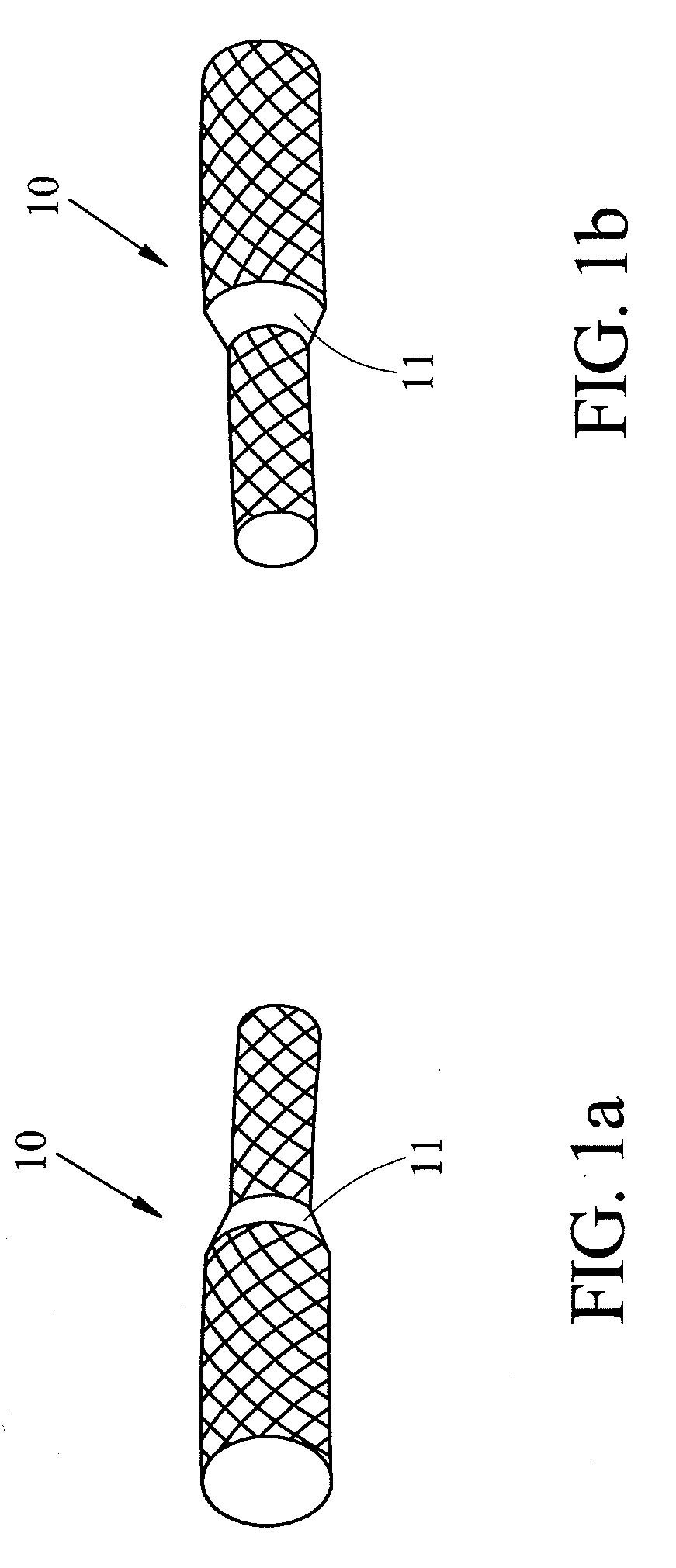 Endovascular Stent Insertion Method