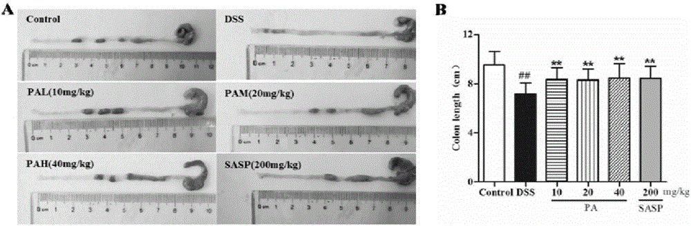 Application of patchoulicalcohol to preparing medicines for preventing and treating ulcerative colitis