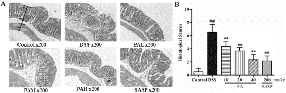 Application of patchoulicalcohol to preparing medicines for preventing and treating ulcerative colitis