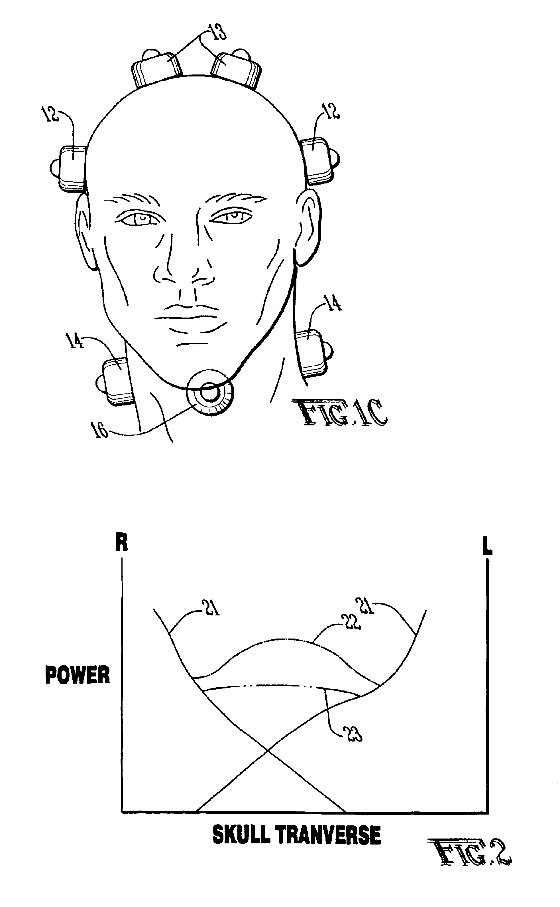 Ultrasound apparatus and method for augmented clot lysis