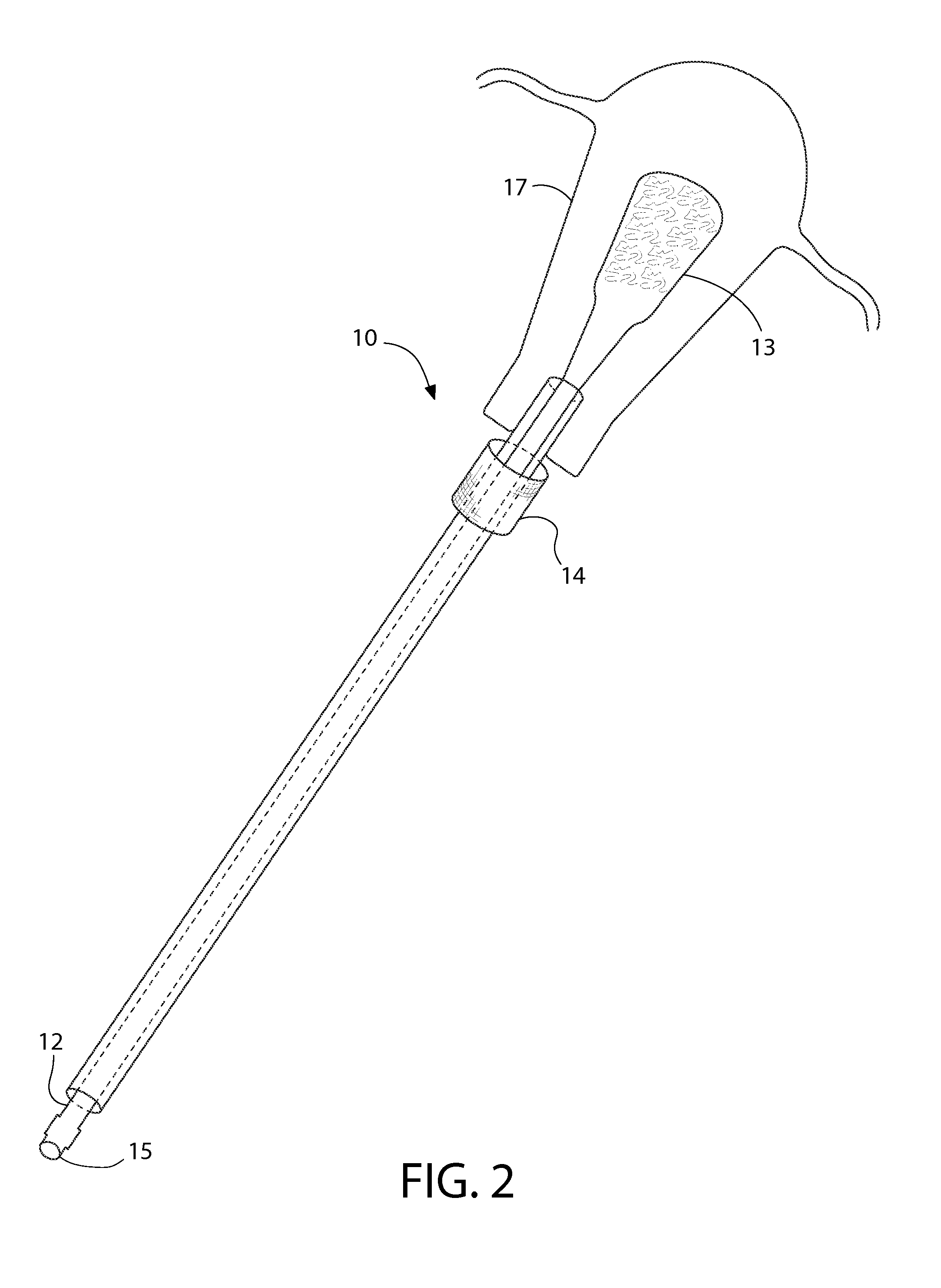 Device for instillation of a chemical agent into the endometrial cavity for purpose of global endometrial ablation