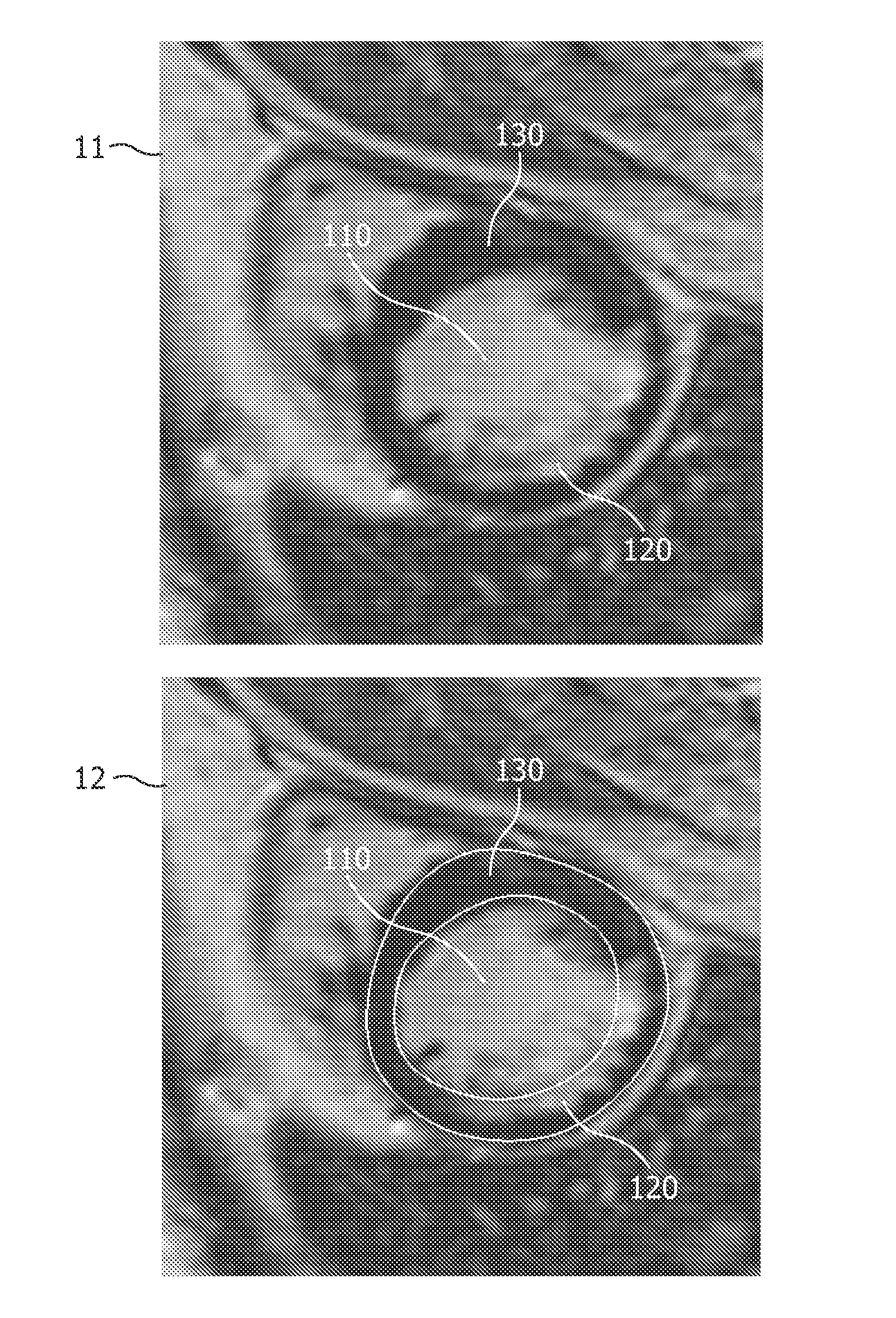 Automatic 3-d segmentation of the short-axis late-enhancement cardiac MRI