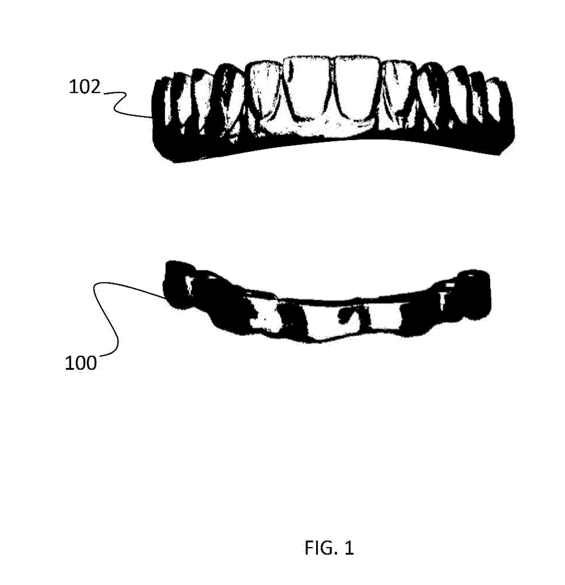 Dental implant prosthesis