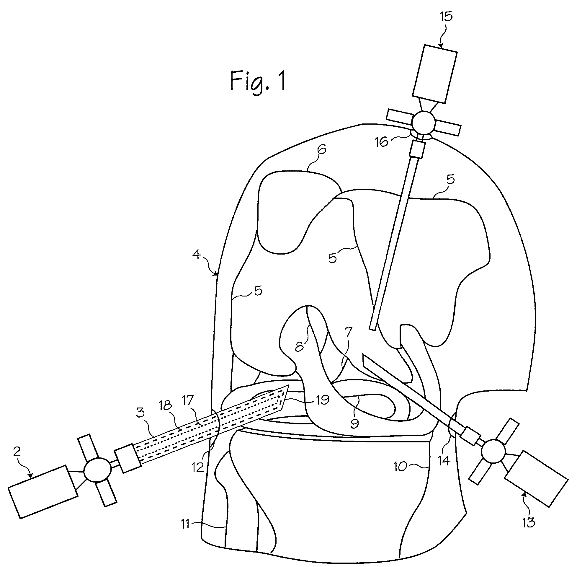 Protective cap for arthroscopic instruments