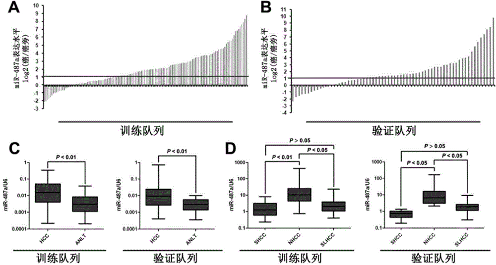 Application of hsa-miR-487a in preparing medicine for treating hepatocellular carcinoma or for postoperative prevention of hepatocellular carcinoma