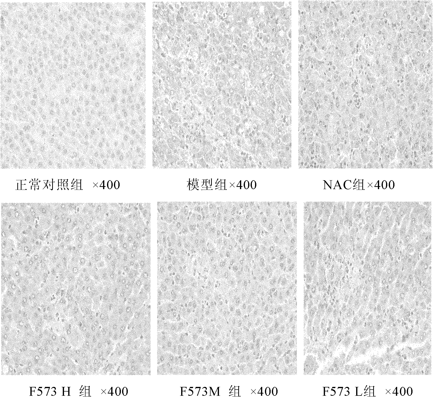 Dipeptide derivative and application of the dipeptide derivative