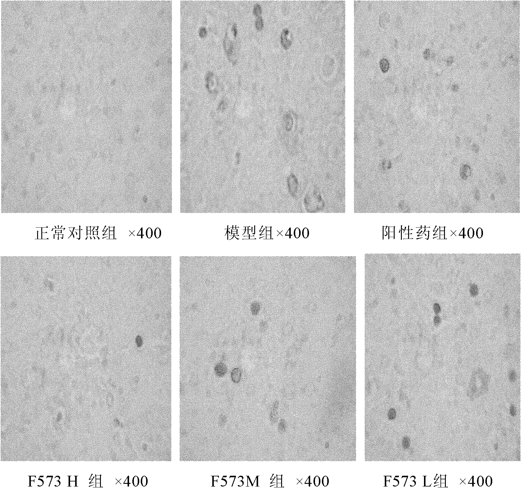 Dipeptide derivative and application of the dipeptide derivative