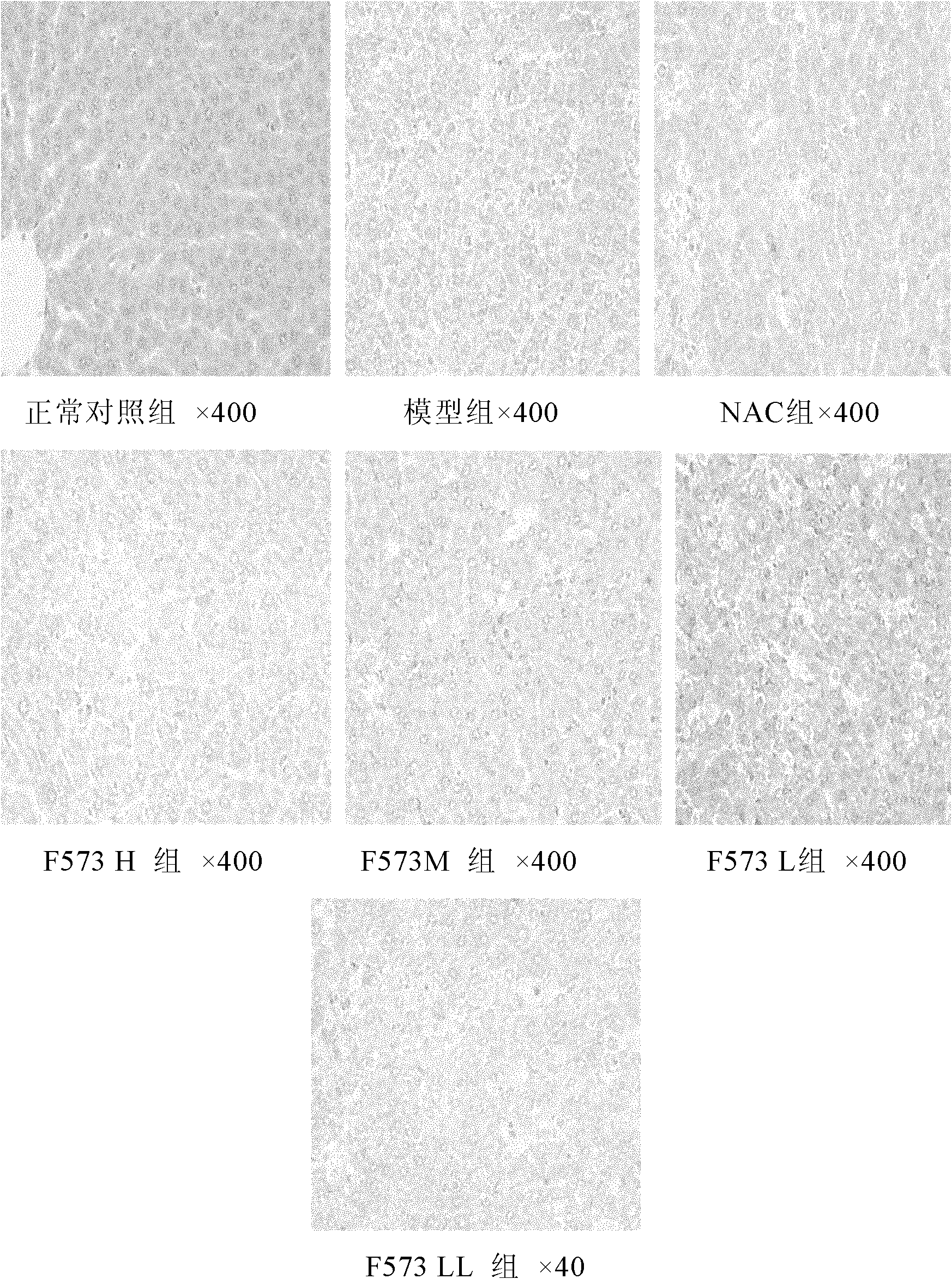 Dipeptide derivative and application of the dipeptide derivative