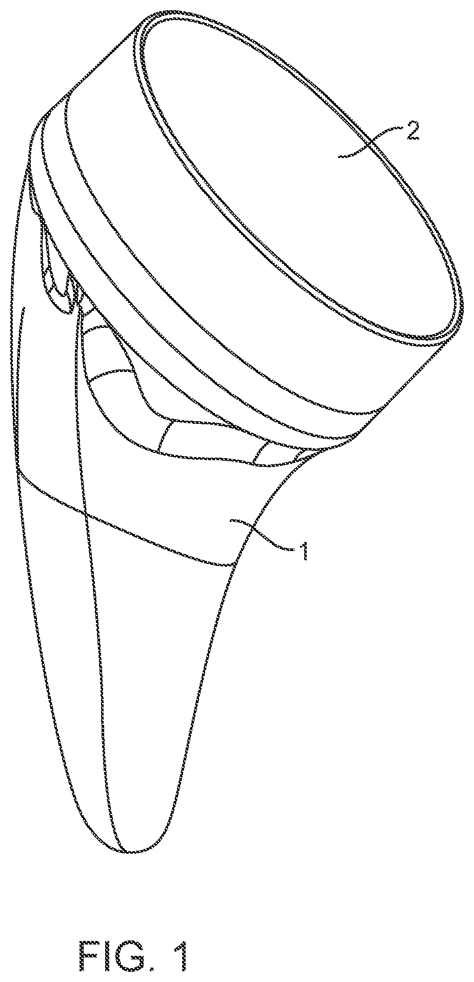 Shoulder arthroplasty implant system