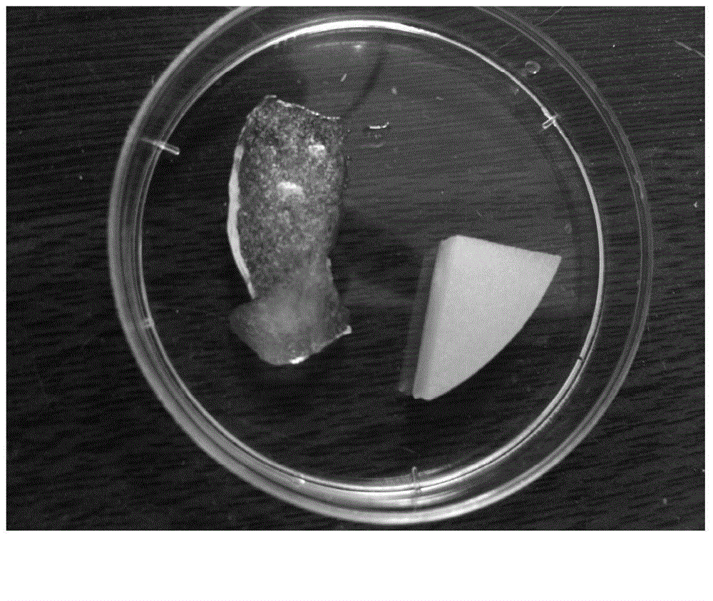 Chitosan hemostatic material formed through covalent crosslinking and preparation method thereof