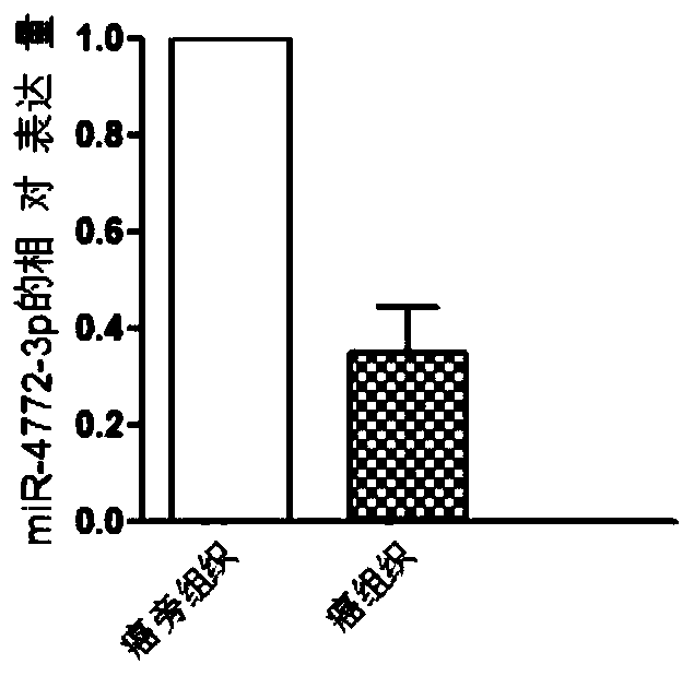 miRNA (micro ribonucleic acid) for diagnosis and treatment on hepatocellular carcinoma