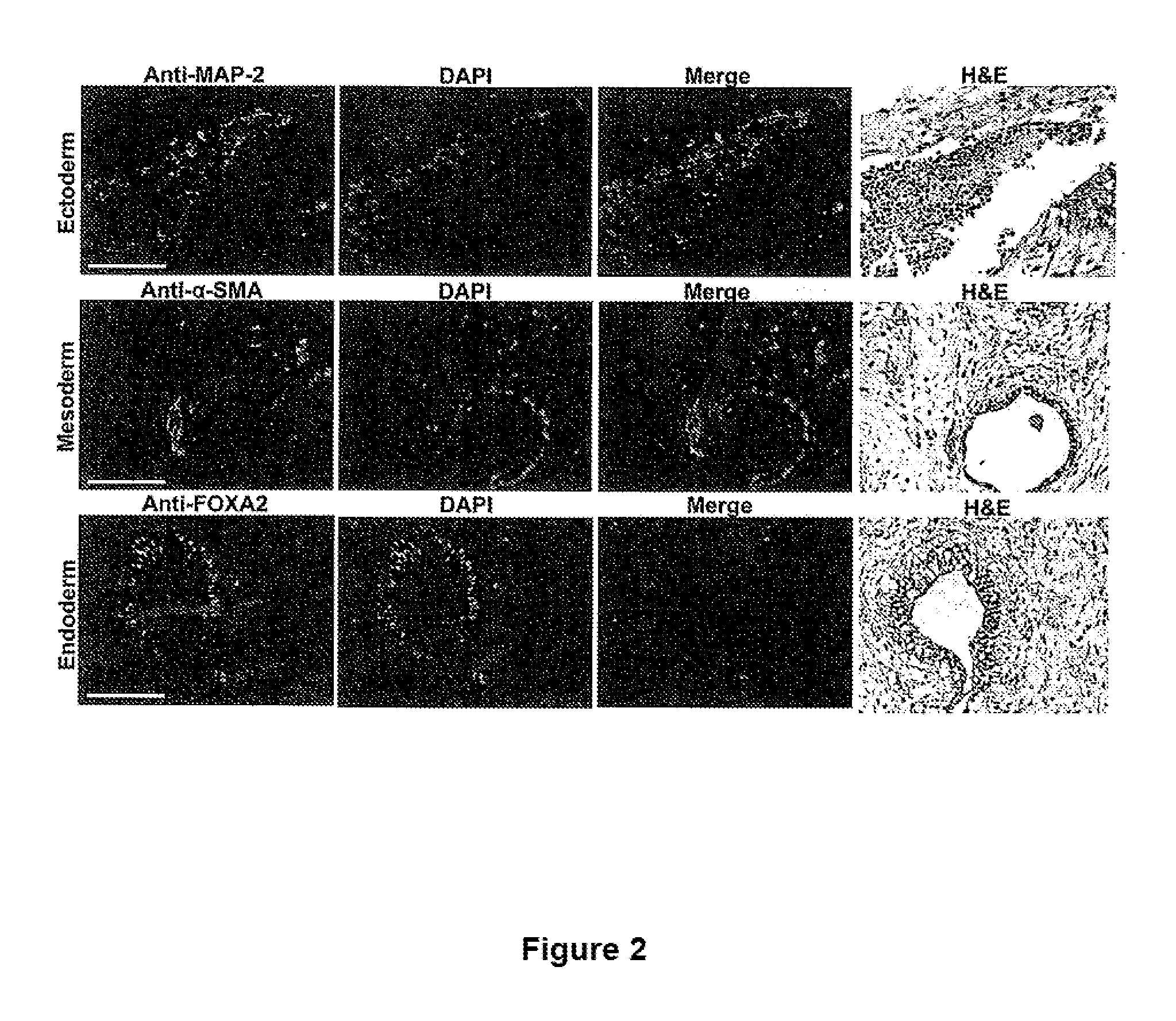 Beta-2 microglobulin-deficient cells