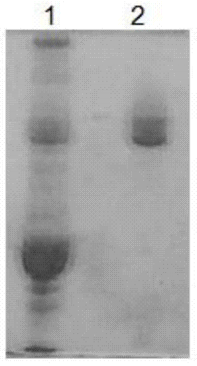 Oncoprotein P185 detection kit