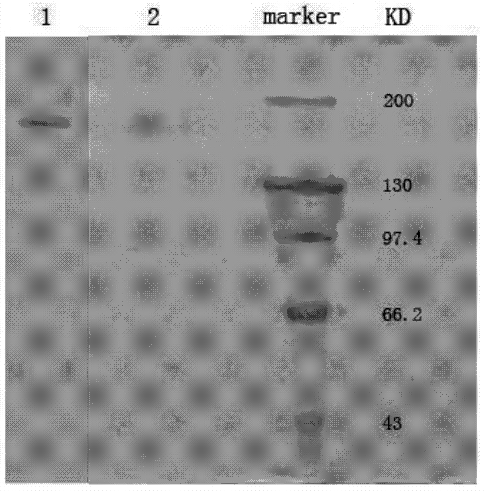 Oncoprotein P185 detection kit